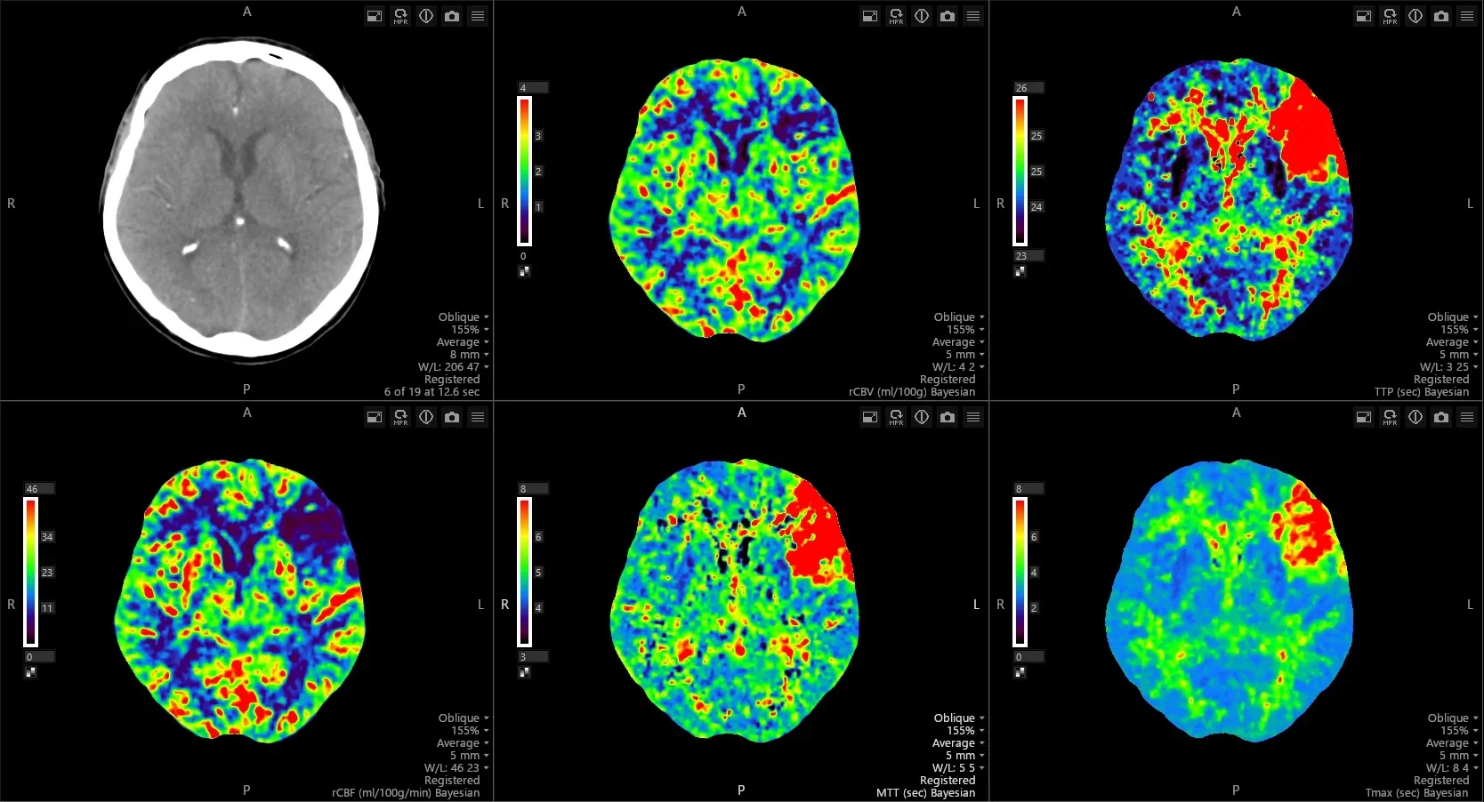 Brain_Perfusion_4D_02.png