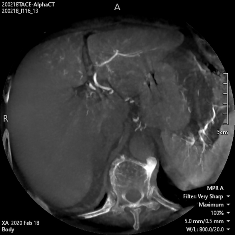Hi-Def imaging*