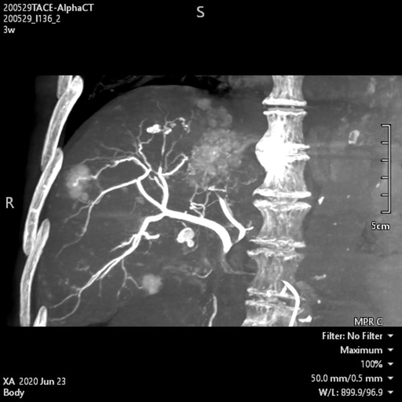 Hi-Def imaging*