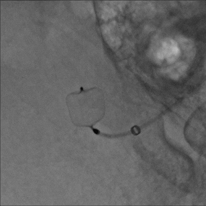 Hi-Def imaging*