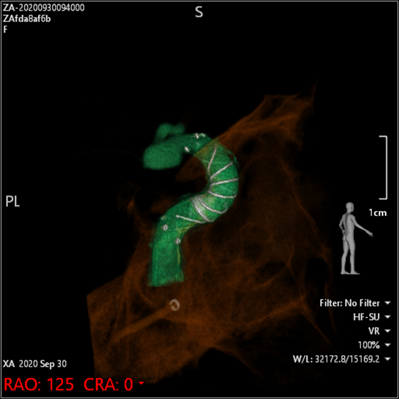 3D images