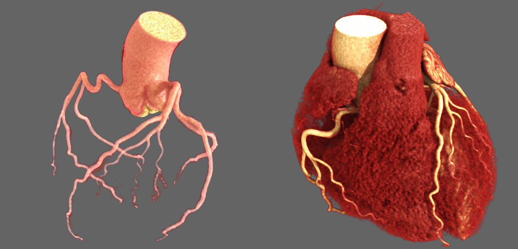 Cardiología