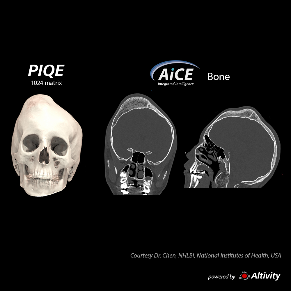 Skull 14-year-old