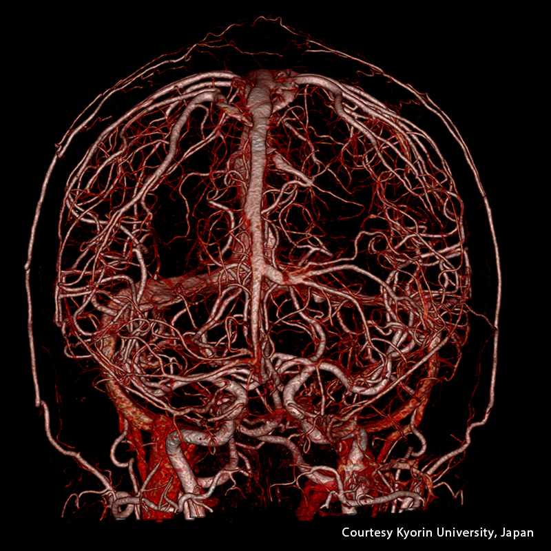 Cerebro