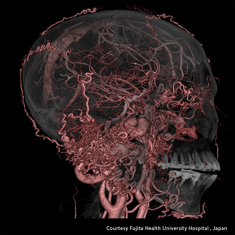 Cerebro