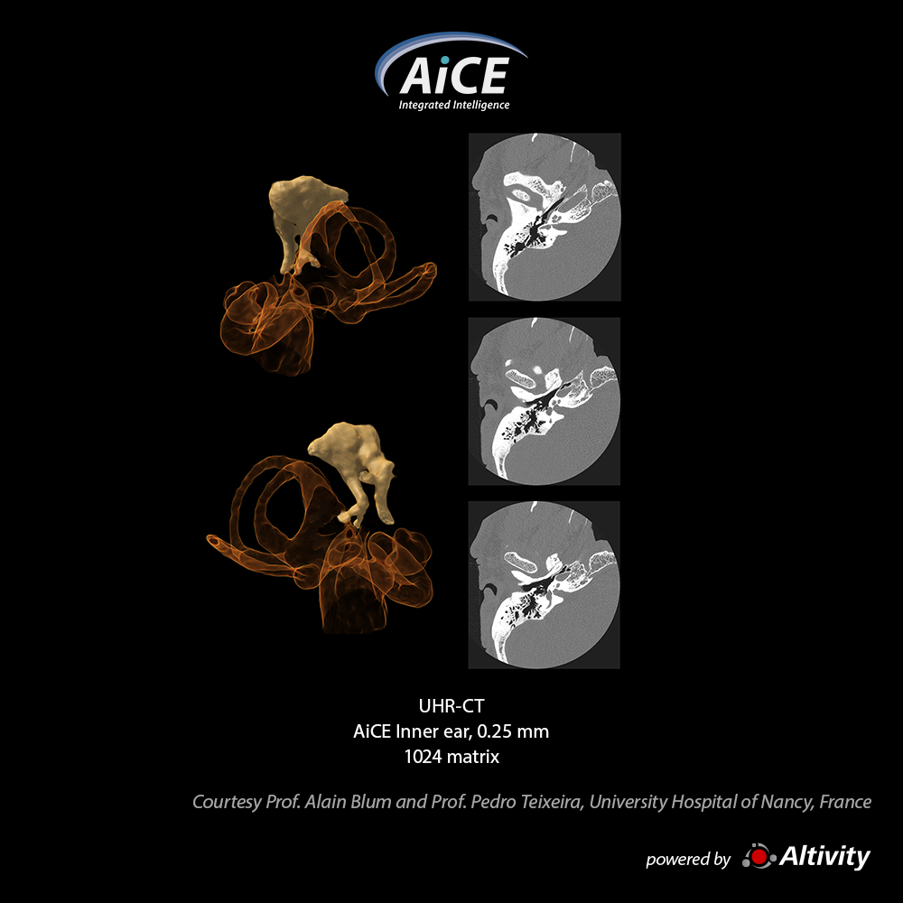 Inner-ear