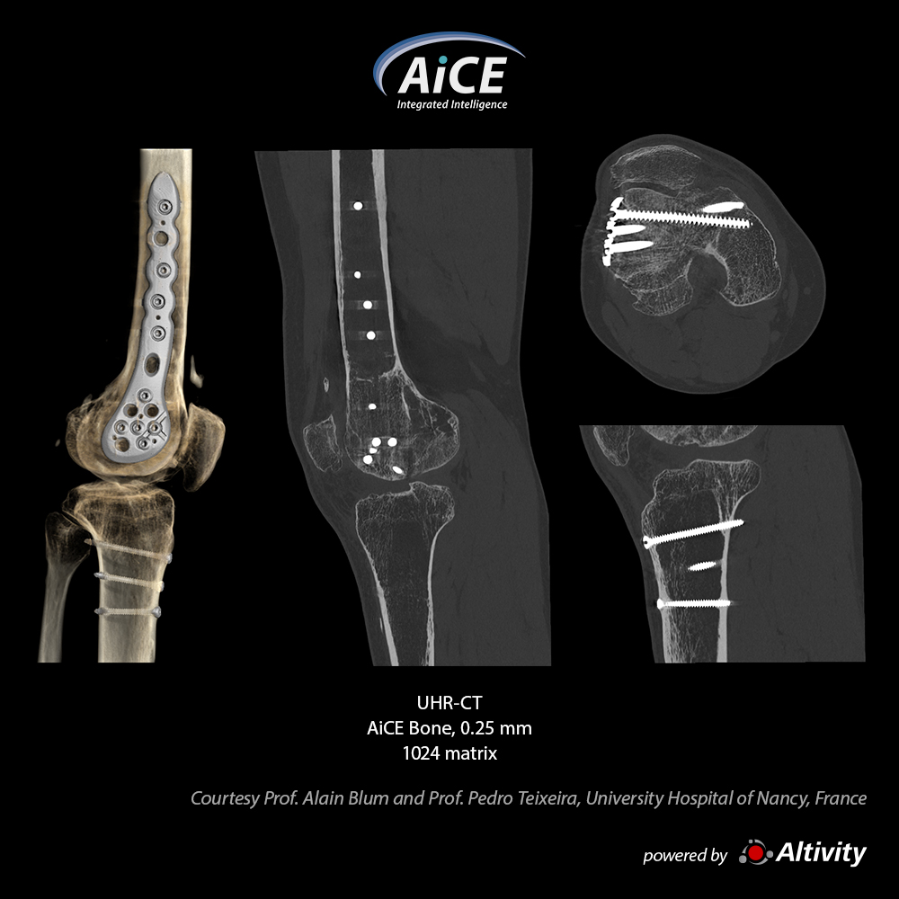 Rodilla-SEMAR