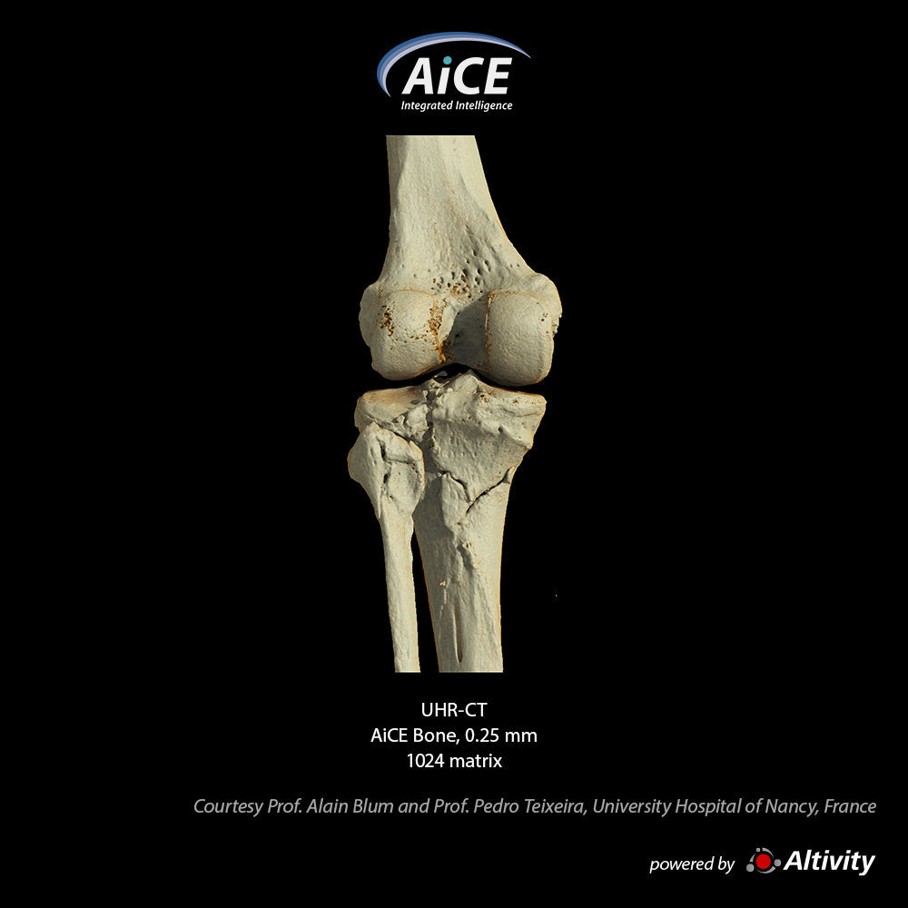 Rodilla