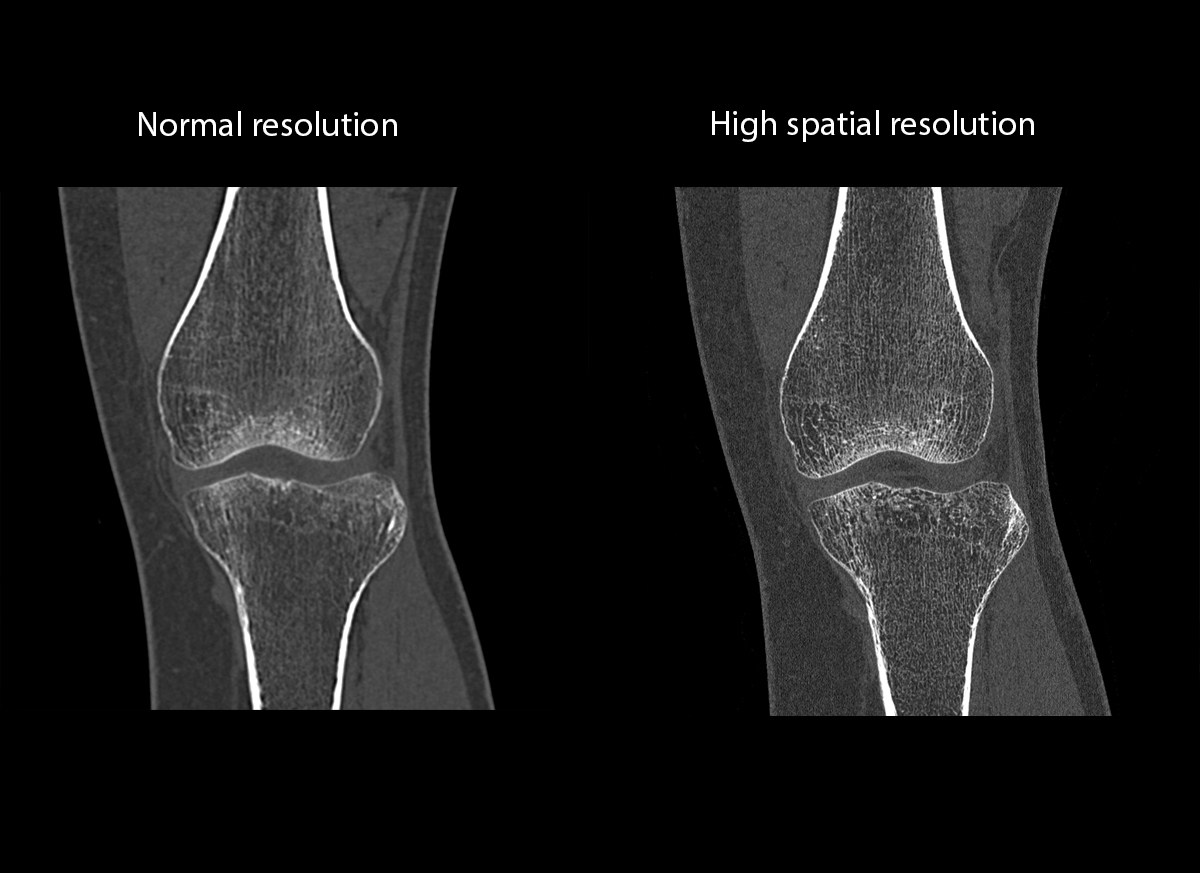 Rodilla