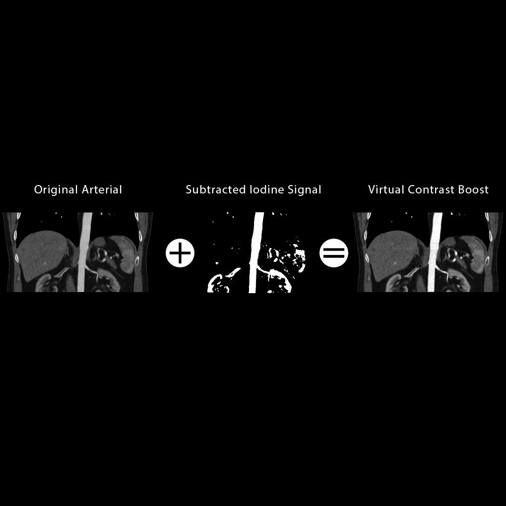 Virtual Contrast Boost